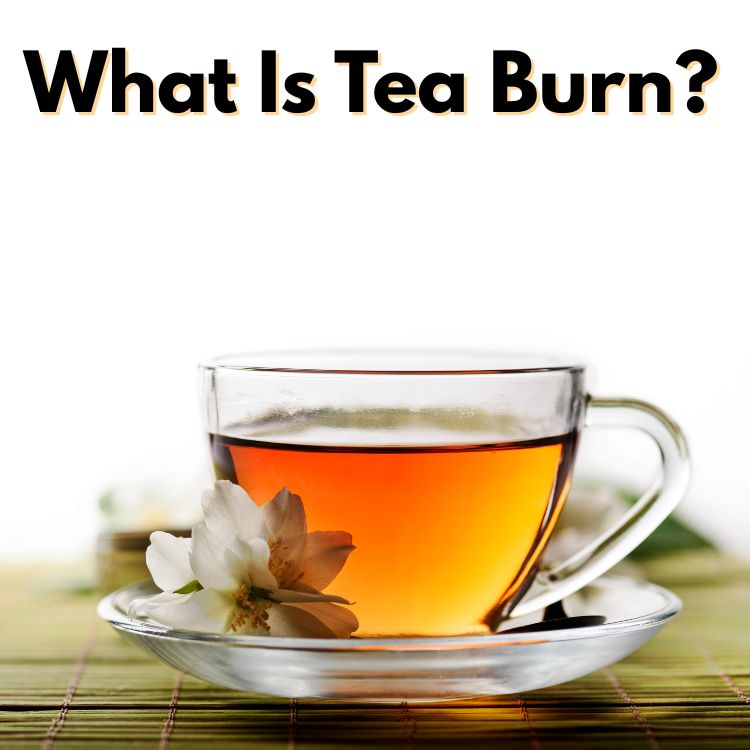 What Is Tea Burn?